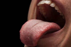 Tongue-Tie Treatment: When to See a Chiropractor