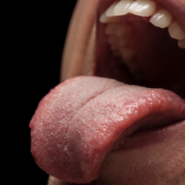 Tongue-Tie Treatment: When to See a Chiropractor