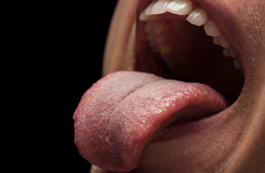 Tongue-Tie Treatment: When to See a Chiropractor
