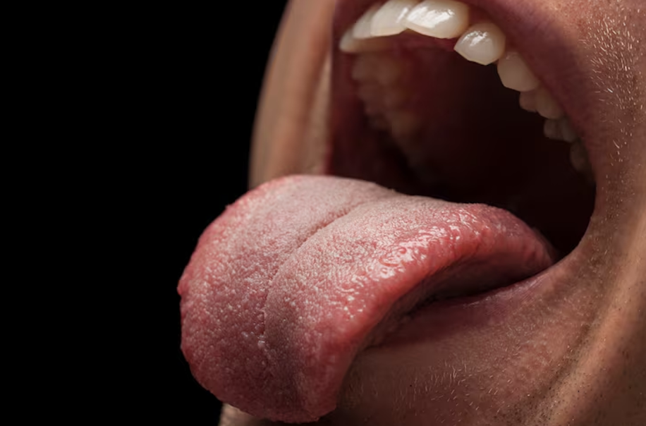 Tongue-Tie Treatment: When to See a Chiropractor
